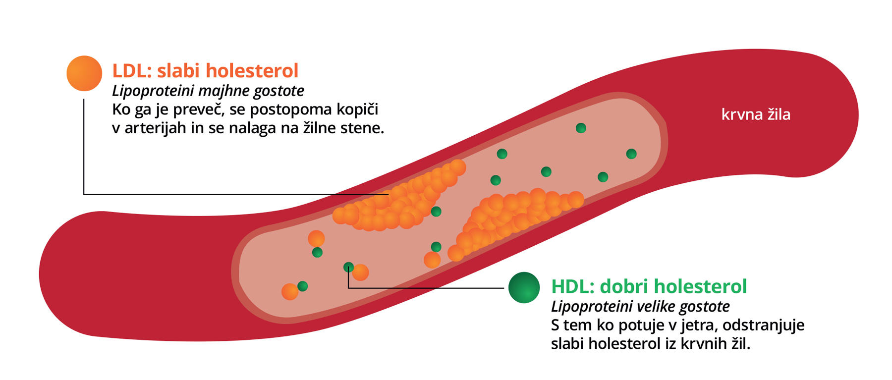Holesterol LDL